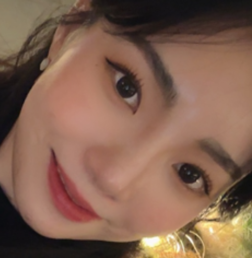 [鼻] モングルグム - 鼻、脂肪移植