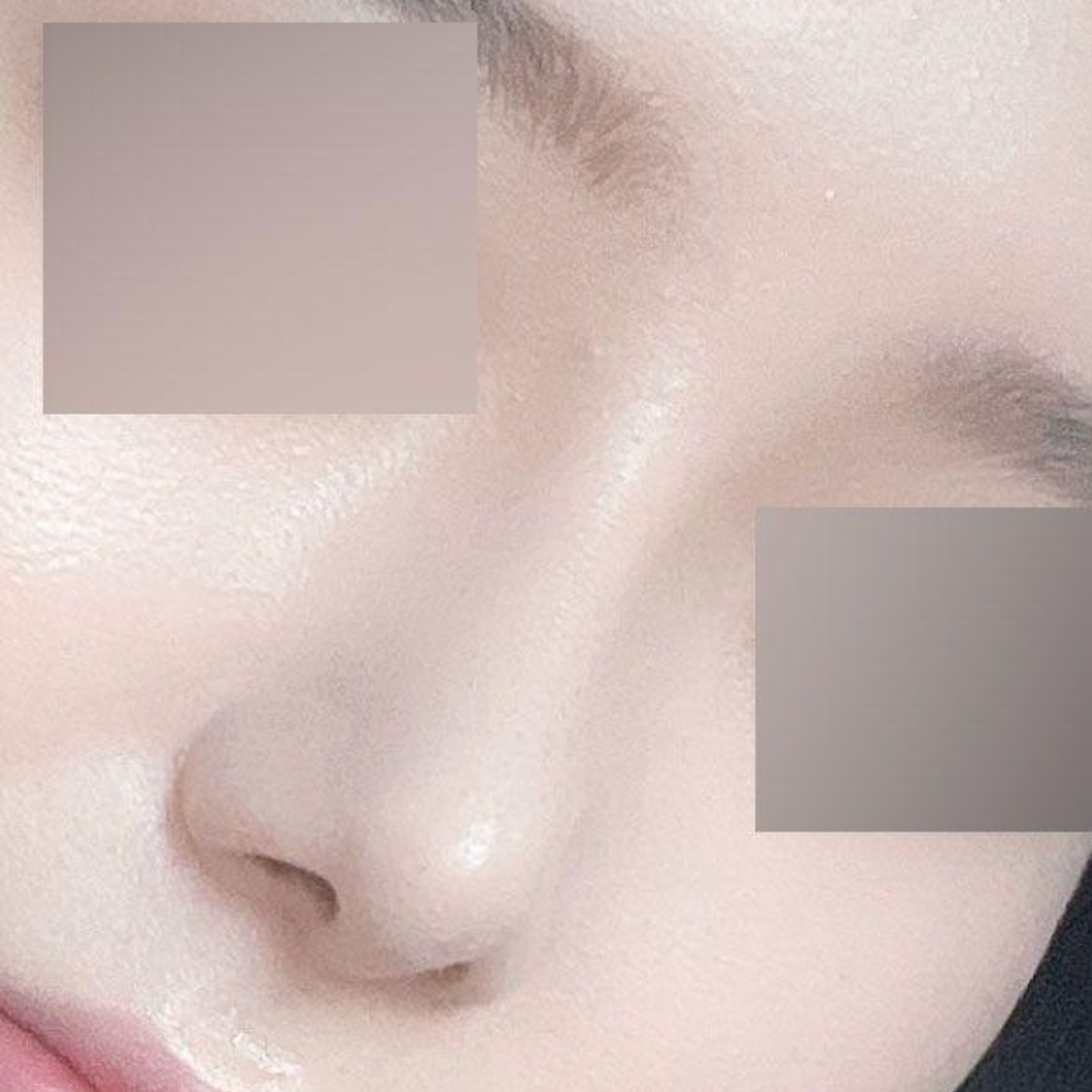 手術してもう1ヶ月になります