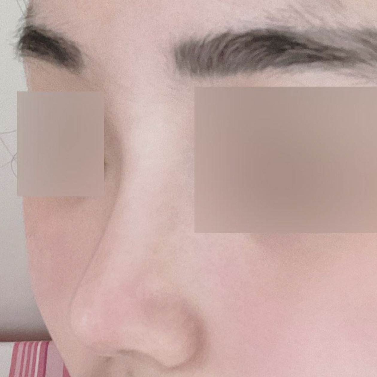 短い鼻＋機能鼻手術をして3ヶ月目です!