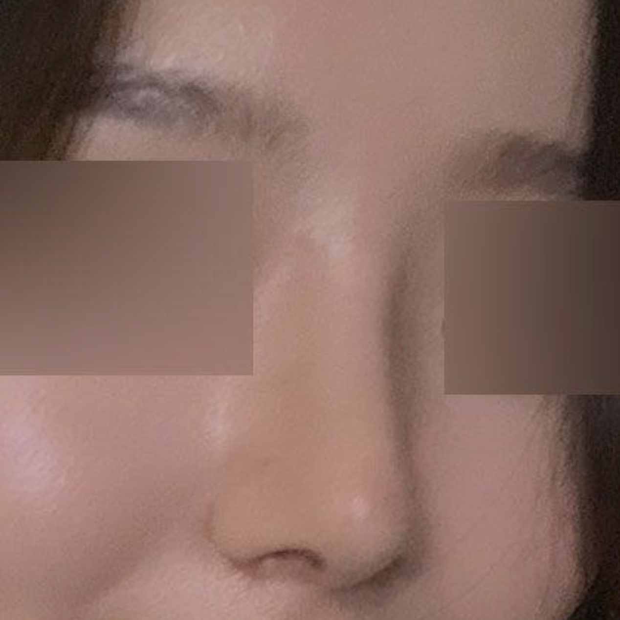 ウィーバースで手術してからついに2ヶ月になりました