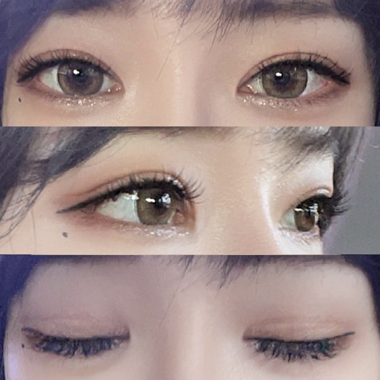 目の再手術をしてから4ヶ月が経ちました。