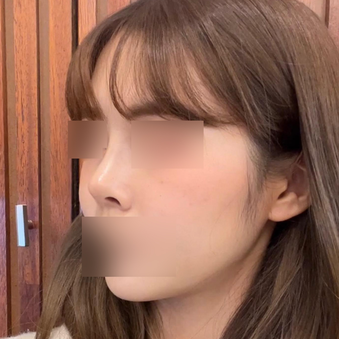 手術後、周りからたくさん褒められます