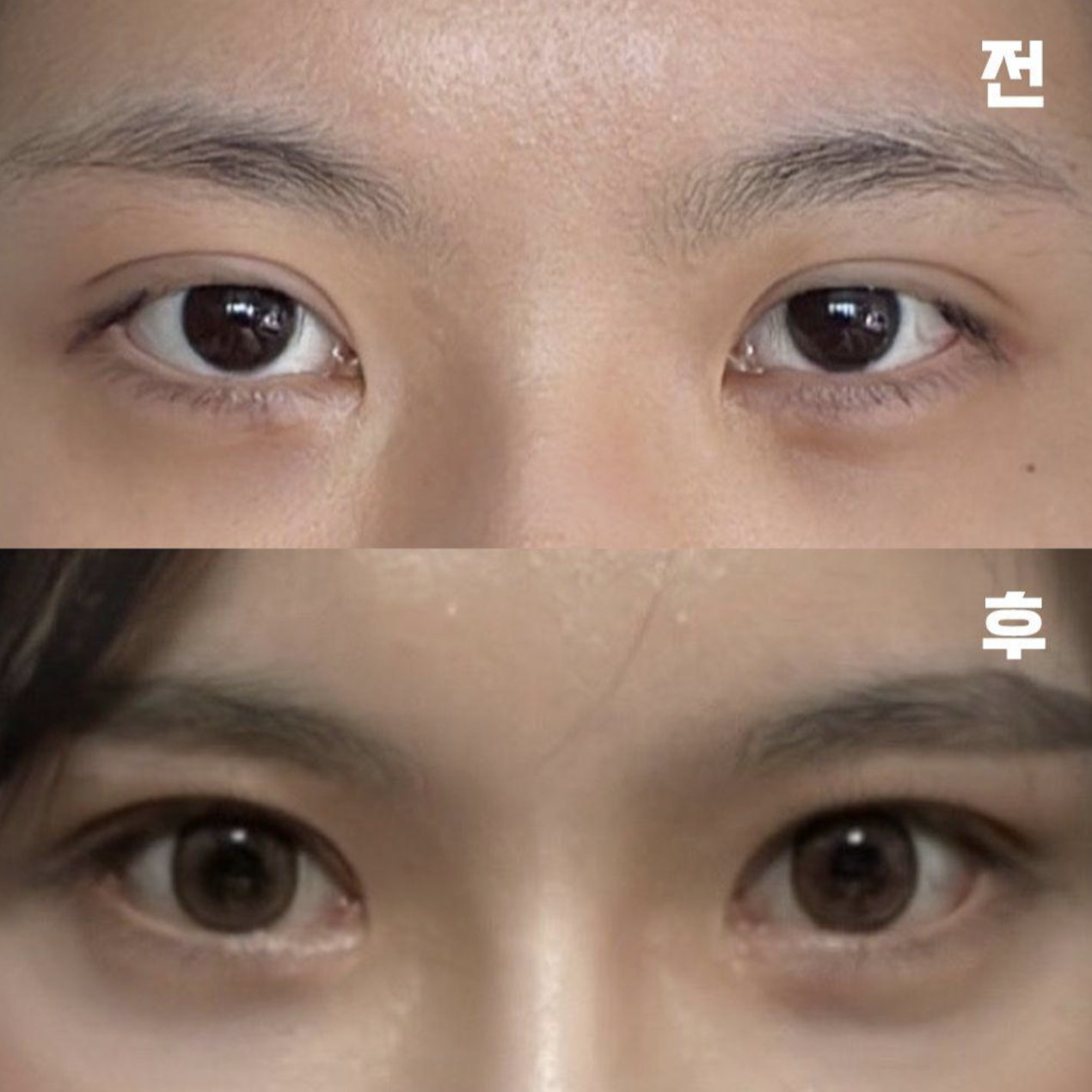 腫れが引いた姿がもう楽しみです