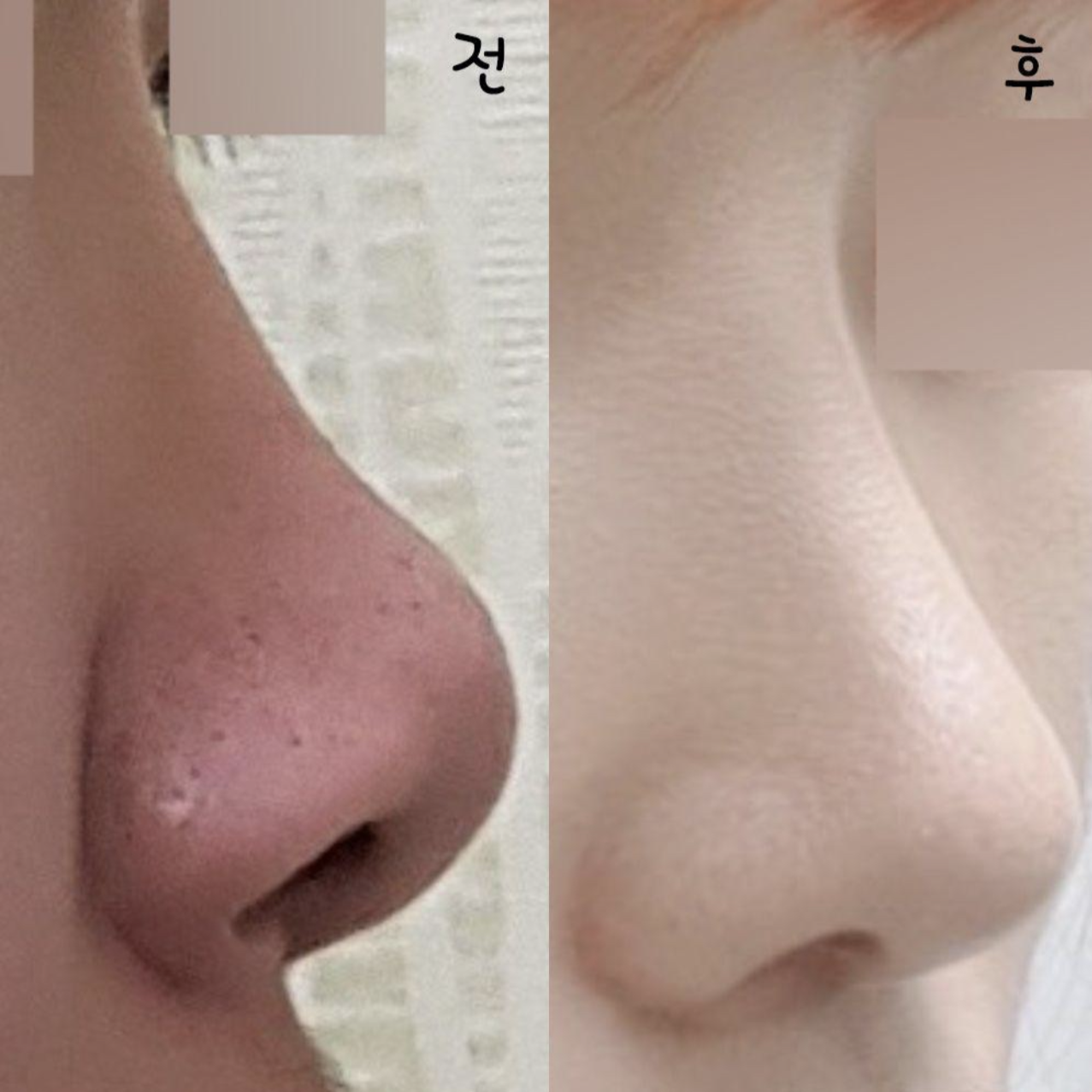 手術をして自信がつきました!!