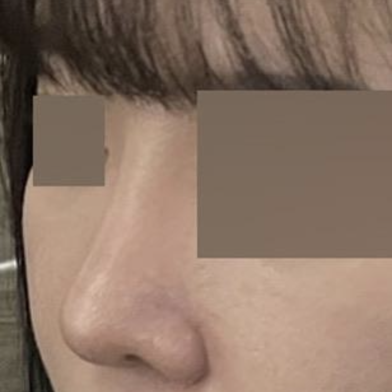 手術してからもう4ヶ月が経ちました!! 笑