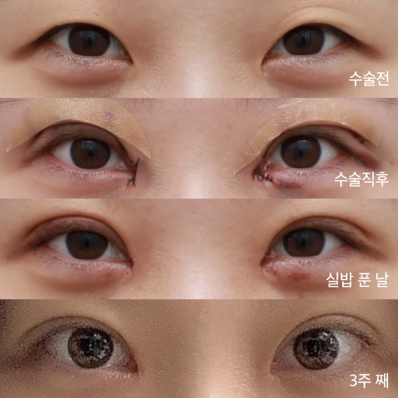 ! 2次レビュー! 本当のレビューです。