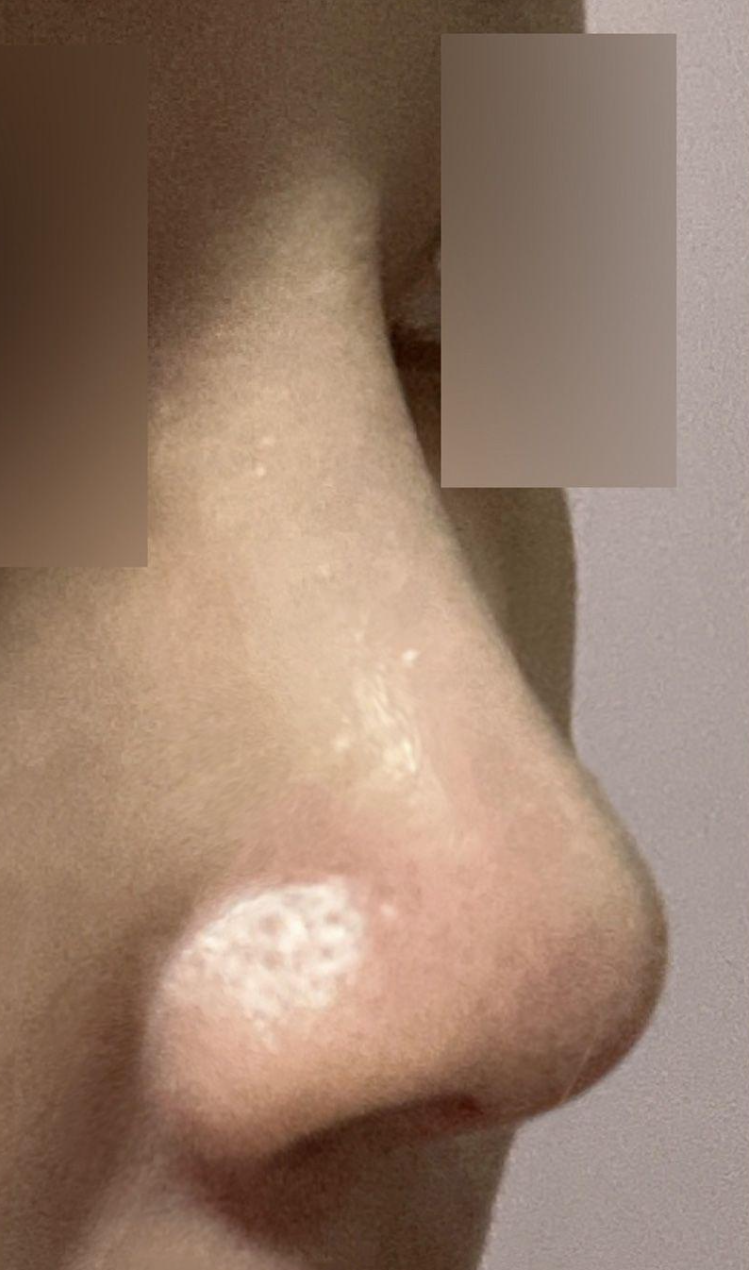 手術からもう6ヶ月経ちました