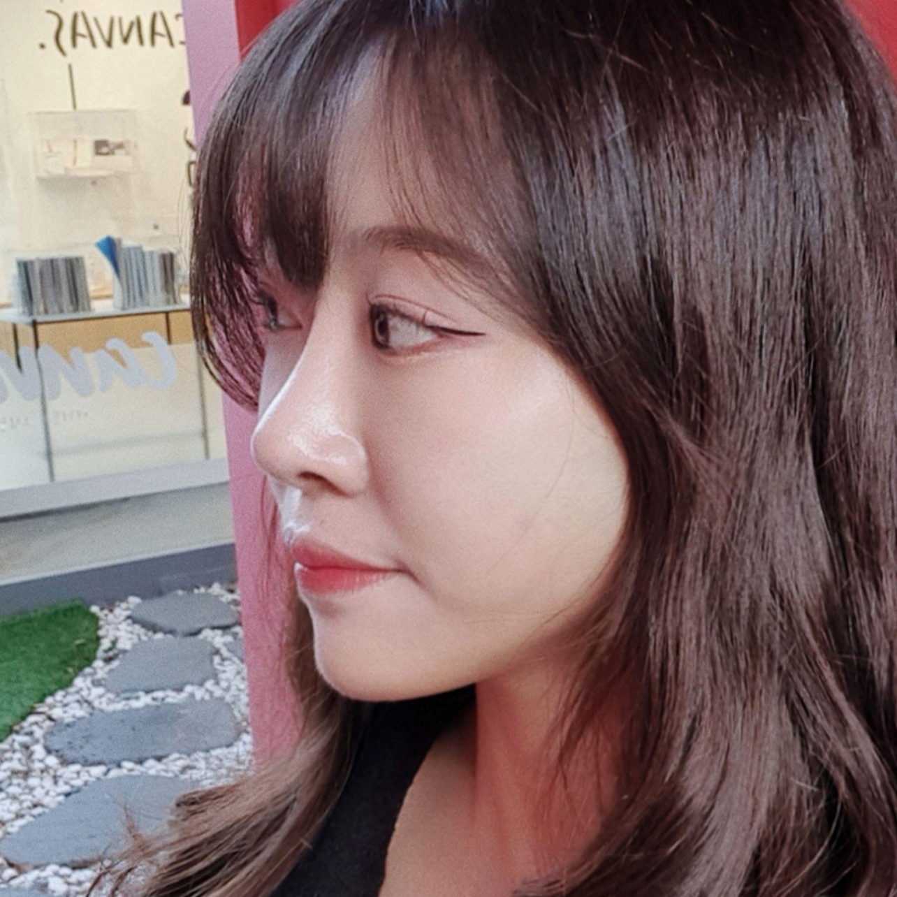 鼻の再手術を受けてから6ヶ月経ちました