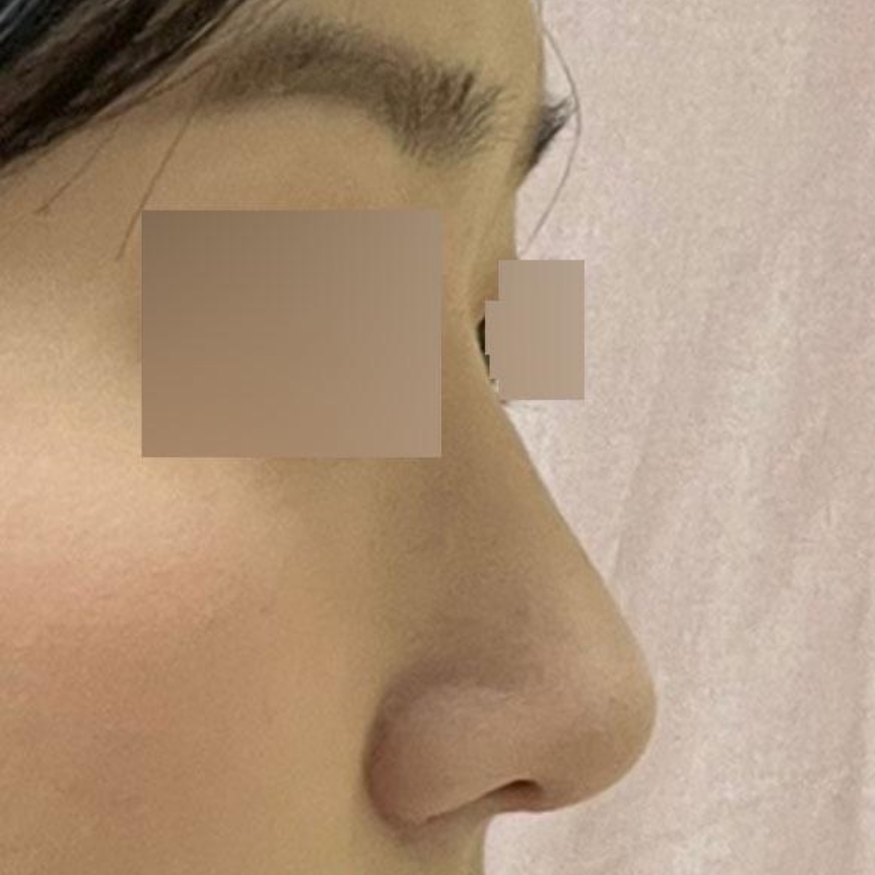 新しい鼻を作っていただき、とても気に入っています(笑)