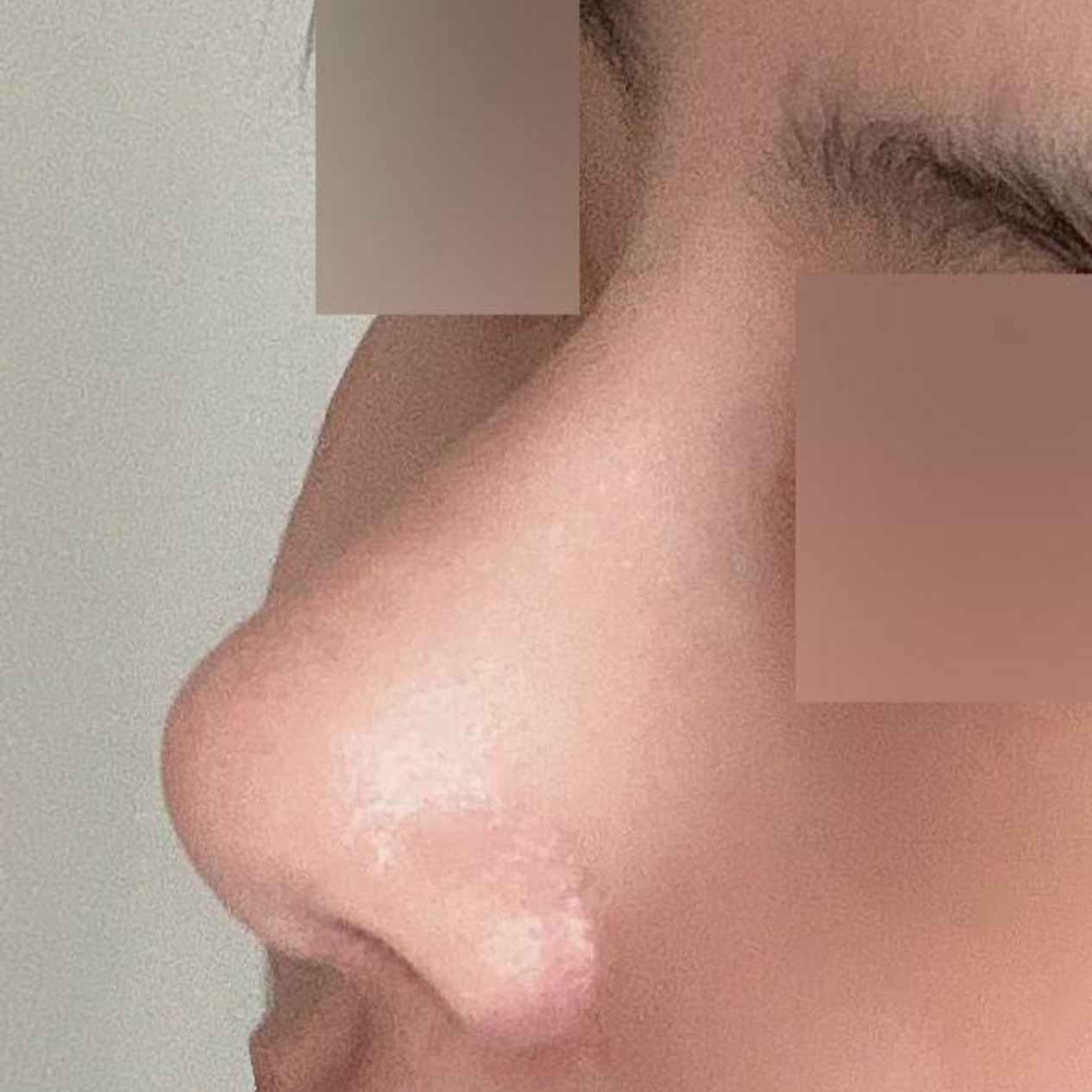 今はもう団子鼻とはお別れしたみたいです（笑）