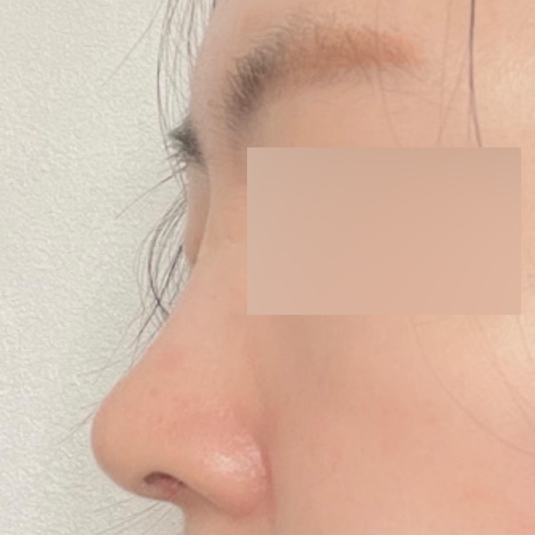 とても綺麗になってすっぴんにも自信が持てるようになりました