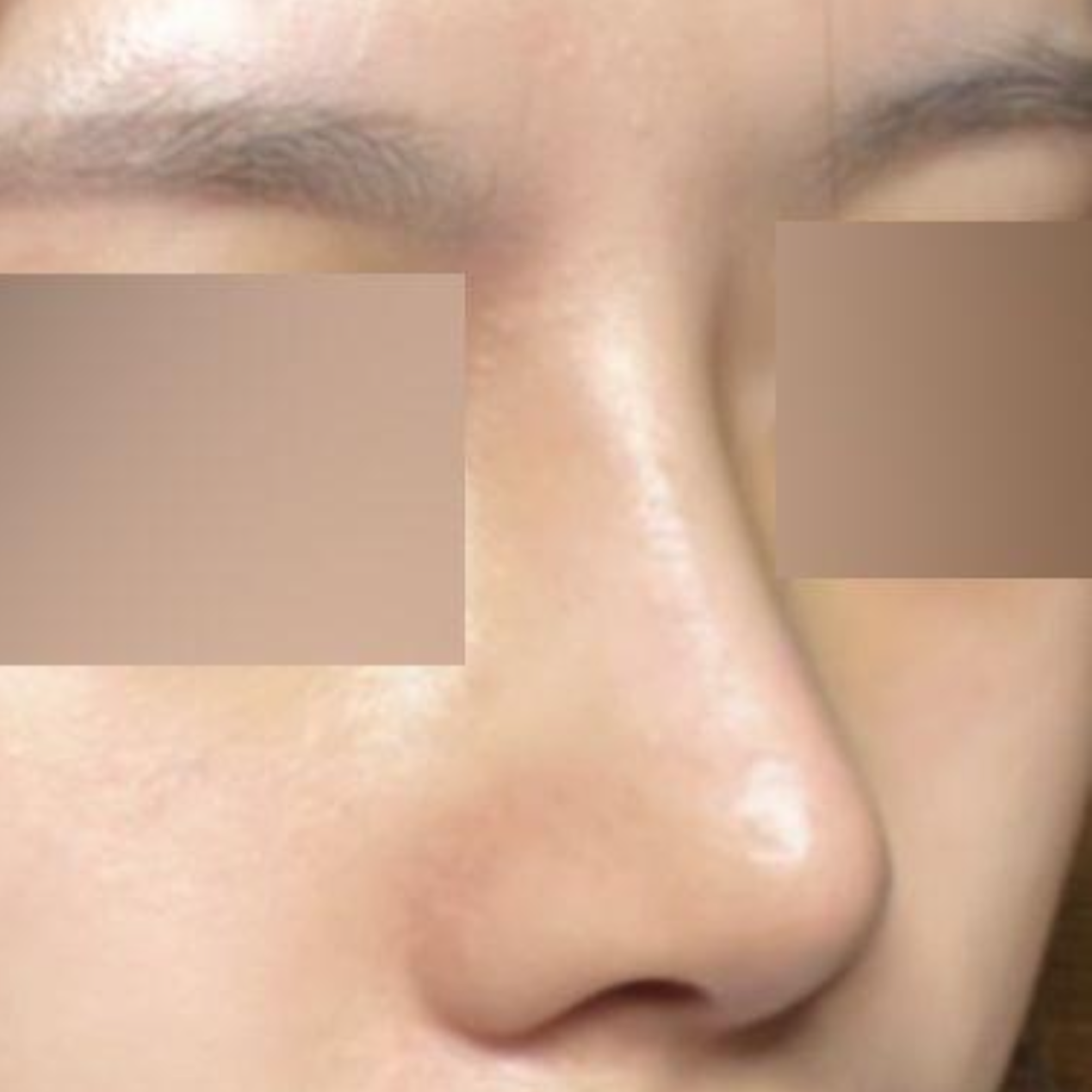 初めての手術だけど成功した感じがすごくしますね