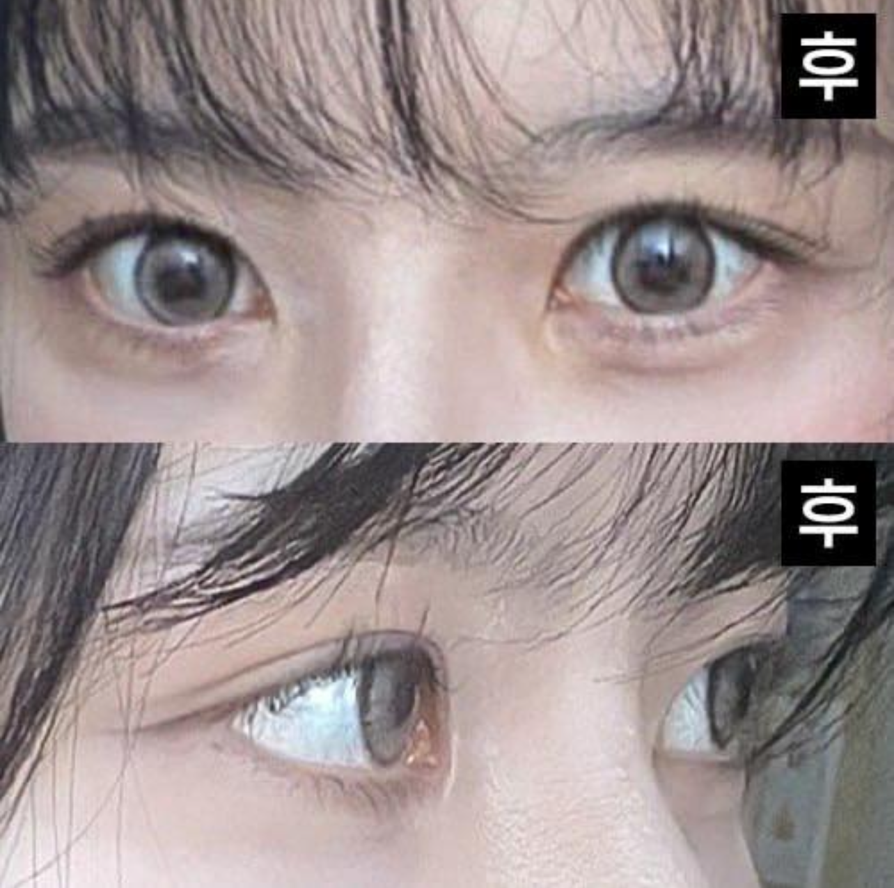 院長先生にお任せして本当に良かったと後悔しないほど思っています