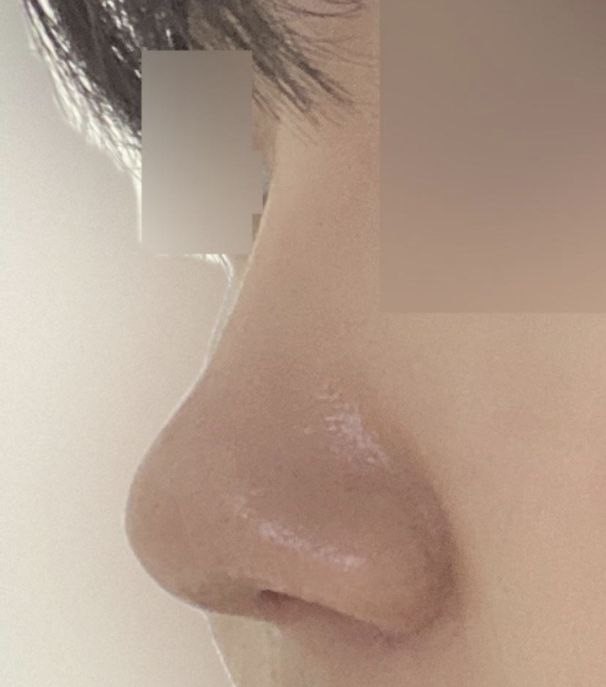 自然に仕上がって満足です