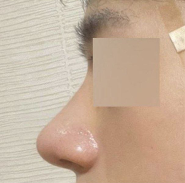 本当に細かく見てくれて、説明も丁寧でした！