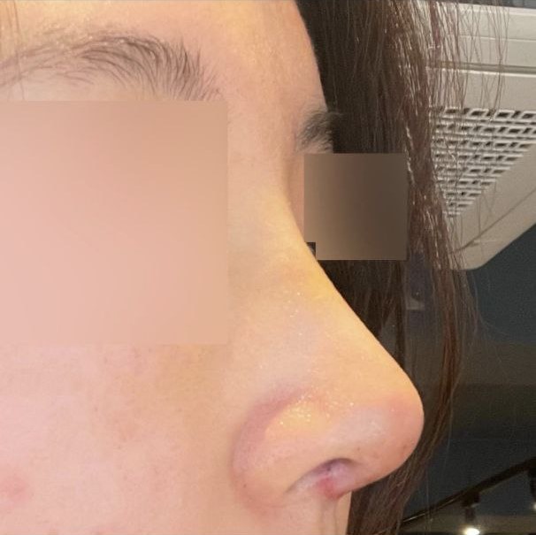 カウンセリングも丁寧だったのに、経過もすごく気にかけてくださいました