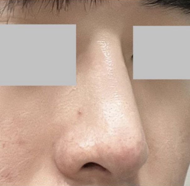 自然な仕上がりを希望していましたが、まさに私にぴったりでした