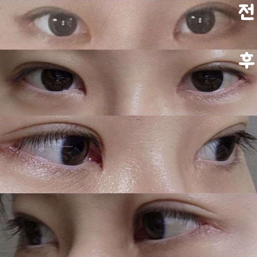 以前よりずっと重苦しさがなくなり、すっきりして見えるのでとても満足しています！