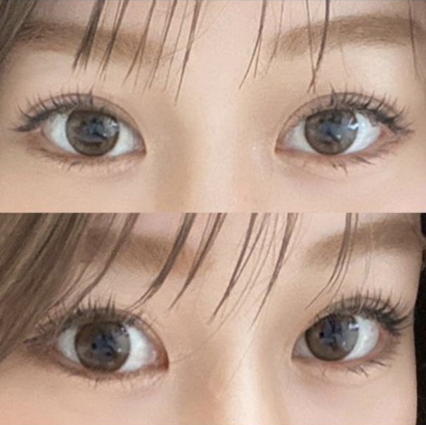 過剰診療もなく、手術後も完全によく面倒を見てくださいましたㅎㅎㅎ