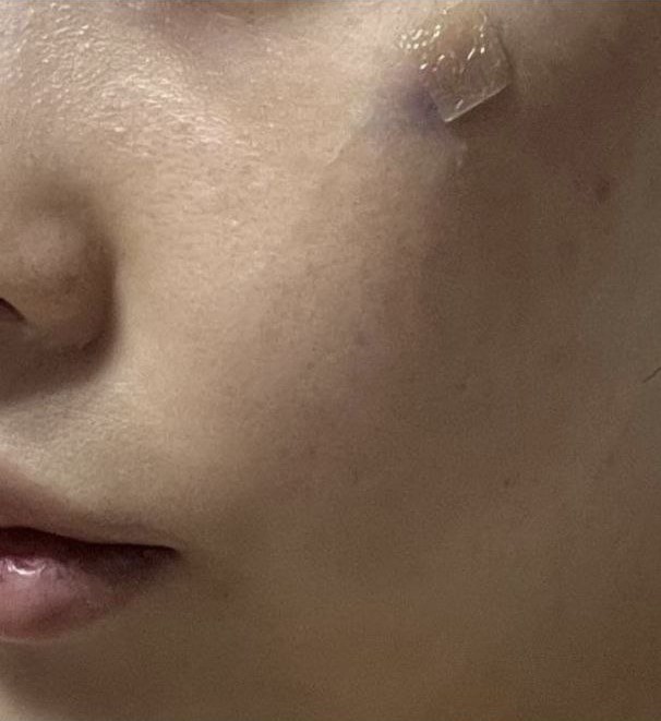 自然に気になっていた部分が改善された感じです!