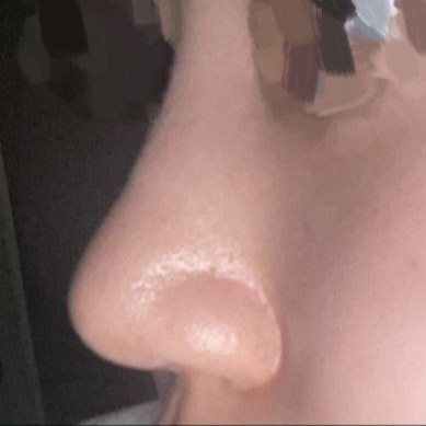 最高ですㅠㅠㅠ ありがとうございます院長先生。。