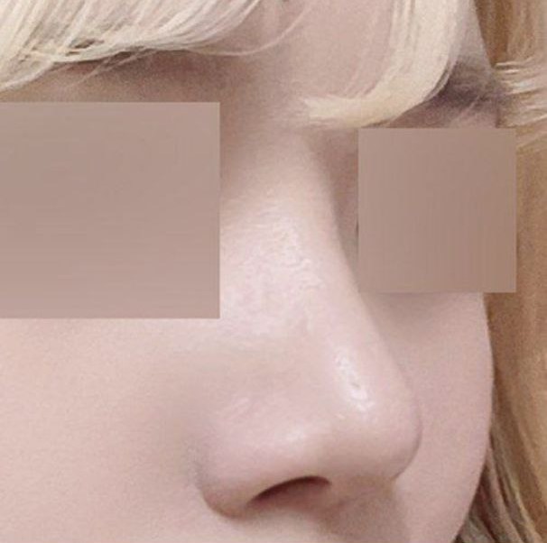 院長先生への信頼感がなければやらなかったと思います（笑）