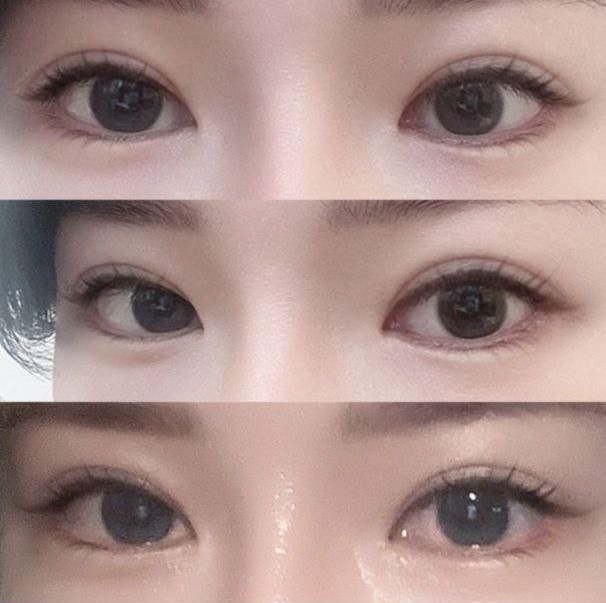 再手術が必要ならみんなウィーバースに行ってください!!www