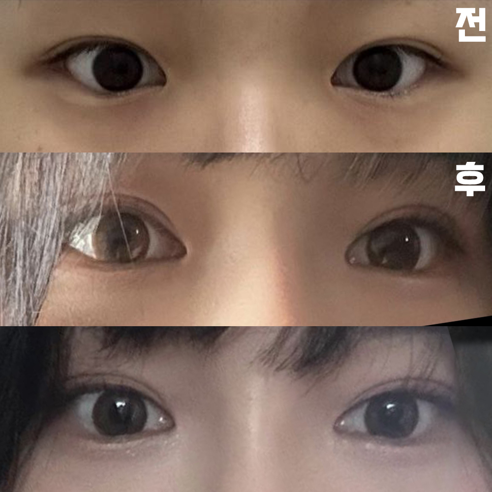 満足のいく結果でとても幸せです。院長先生ありがとうございます!!