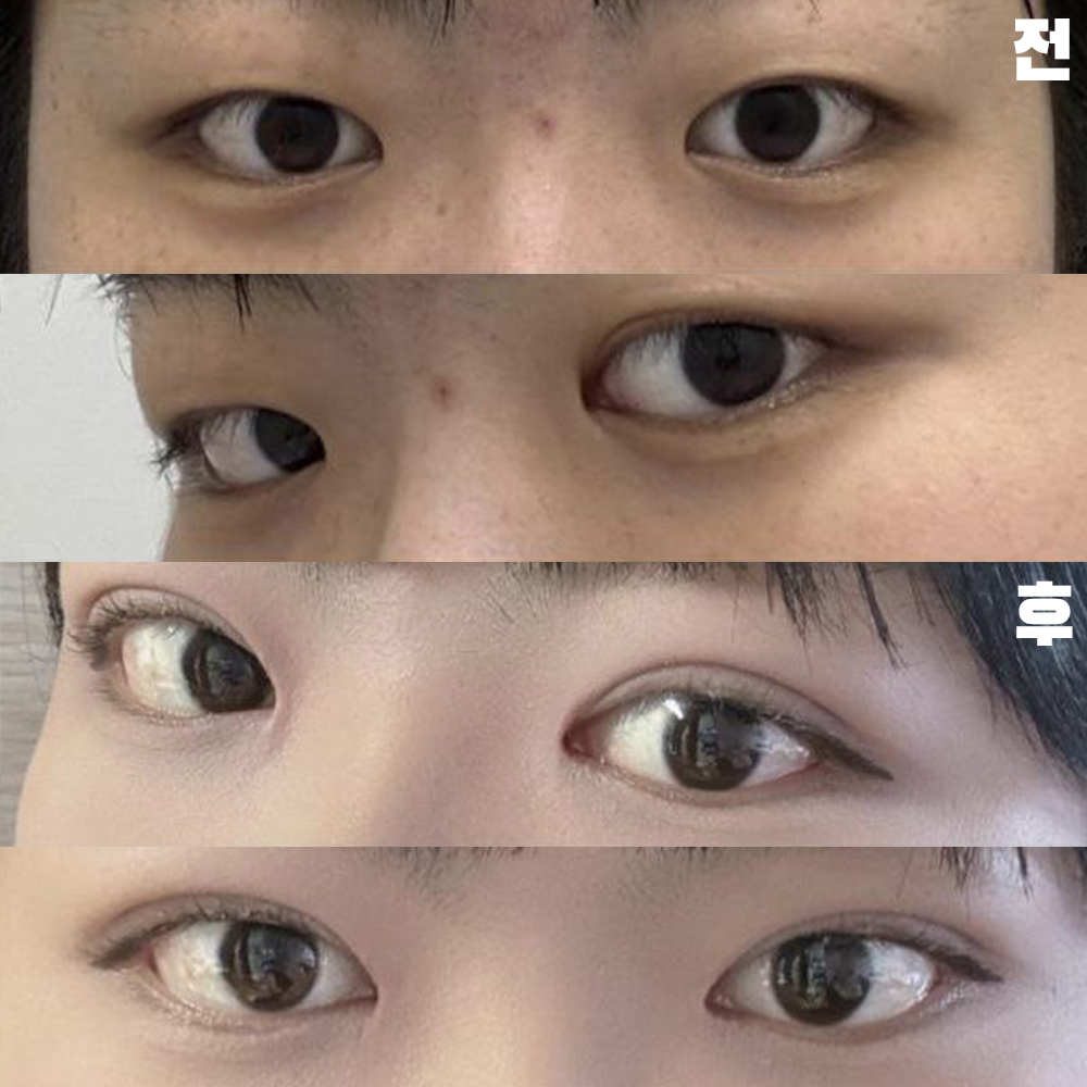 痛くないように繊細にしてくださってありがとうございました。