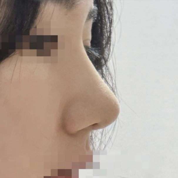 もっと早くやればよかったと後悔していますㅠㅠ