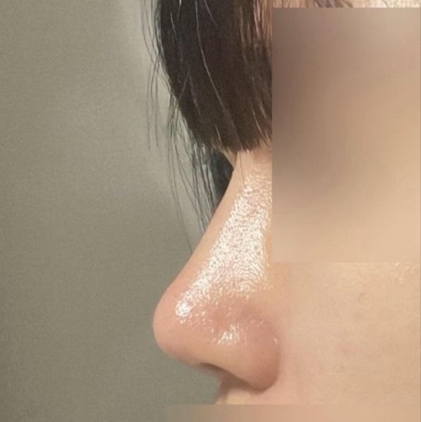 本当に言わなければ自分の鼻だと思うみたいです（笑）