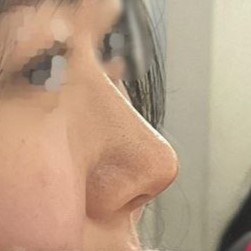 今、満足度が非常に高く、いつも鏡を見て感心しています...