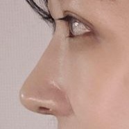 美しい目と鼻を作っていただきありがとうございます