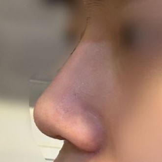 当日予約金の強要もなく、相談もとても良かったです!