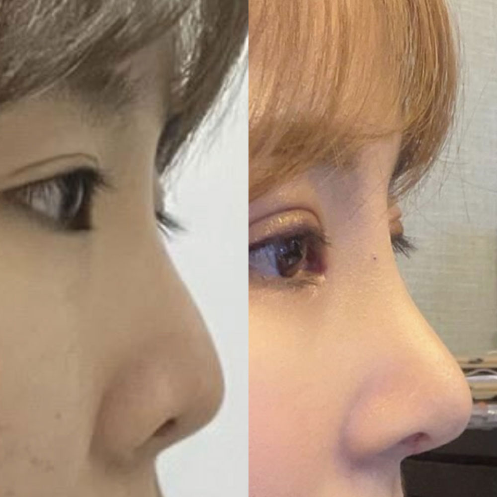 鼻再手術はソ院長、目再手術はシム院長にお願いしました