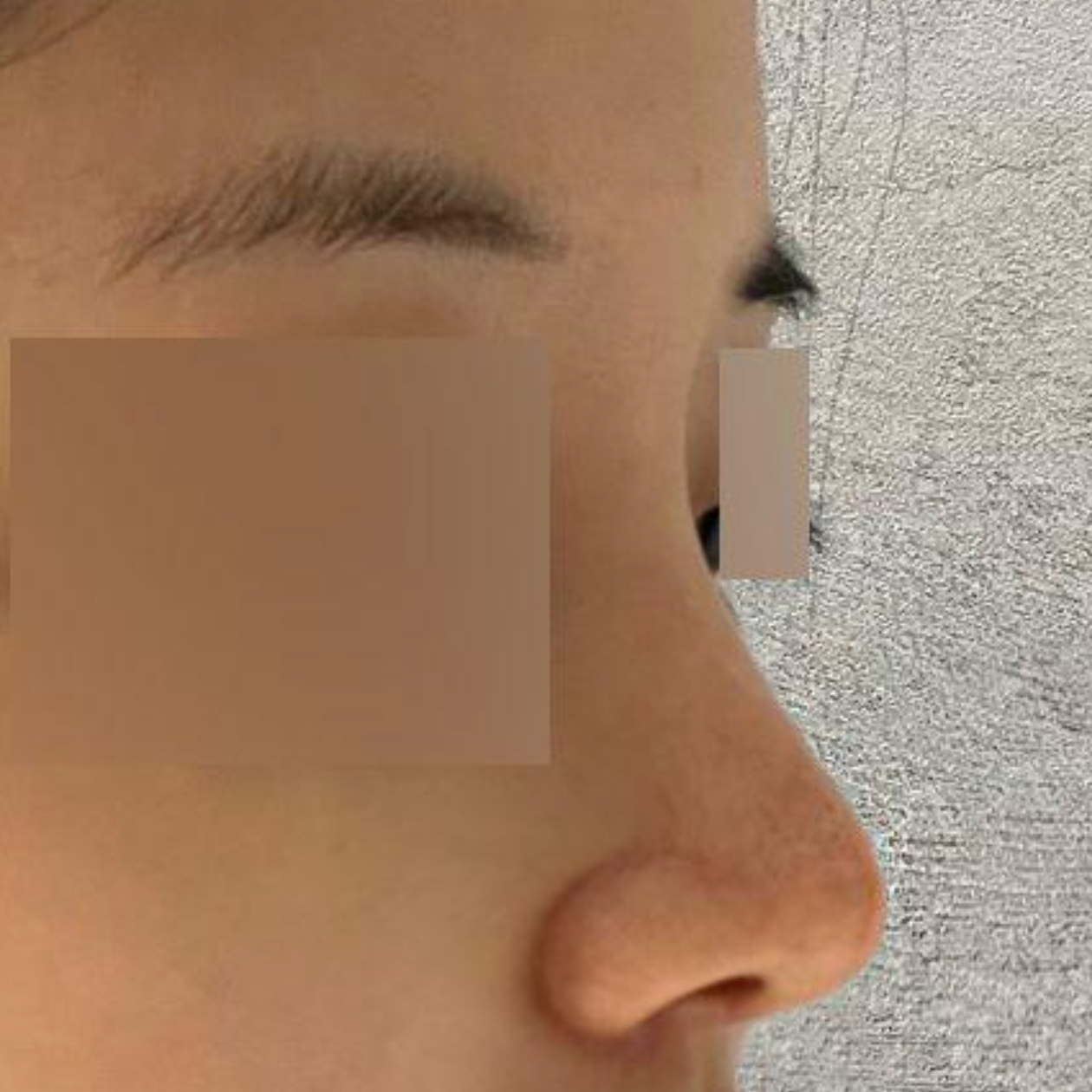 手術してからもう2ヶ月になりました