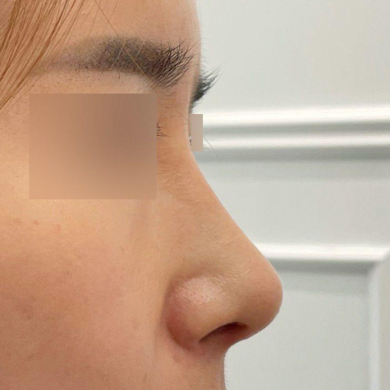 本当に綺麗に手術ができました^^