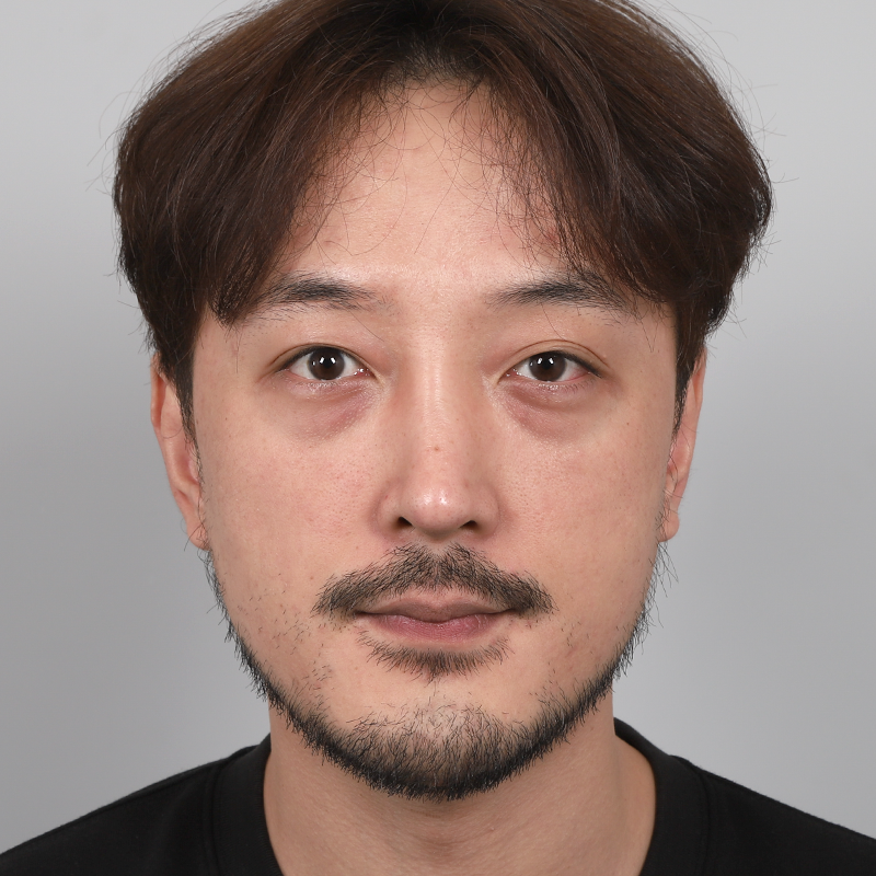 #部分切開 #目の下の脂肪再配置