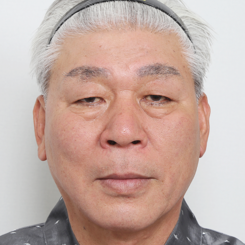 #下眼瞼眉下リフト