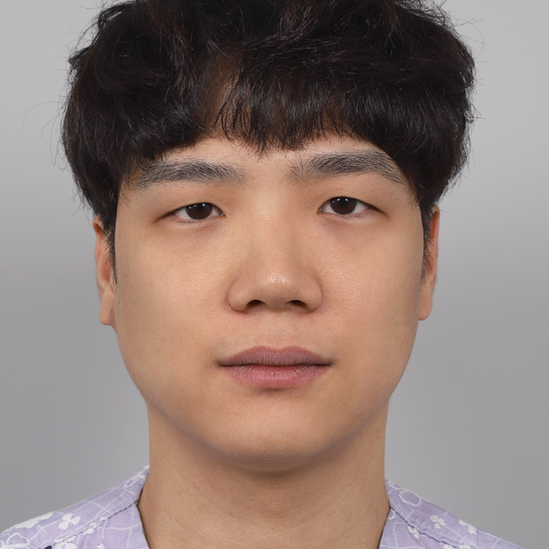 #部分切開 #目つき矯正 #鼻筋(シリコン) #鼻先(自家軟骨) #小鼻縮小 #団子鼻矯正